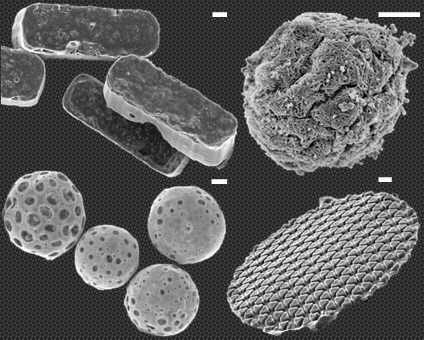 Image 1. Microparticles