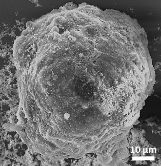 Image 2. Mineralized microsphere
